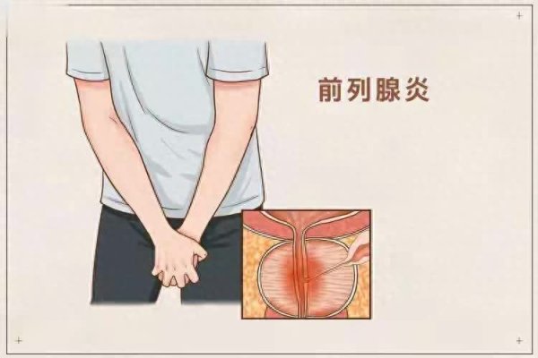 金牛速配 男性易患前列腺炎？远离6种行为别大意